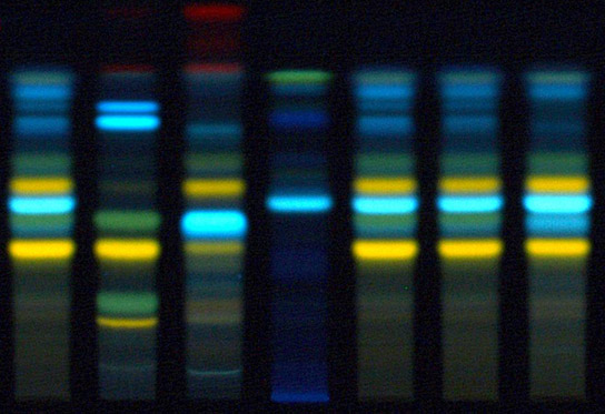 Lipoid-Kosmetik_Our-Company_Quality-Management_Quality-Control_Text1 HPTLC fingerprint showcases the power of our full spectrum extracts