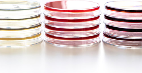 Lipoid-Kosmetik_Our-Company_Quality-Management_Quality-Control_Text2 Petri dishes to test microbiogy and hygiene